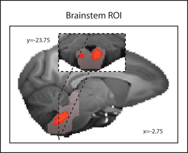 https://cdn.ncbi.nlm.nih.gov/pmc/blobs/d99e/4151964/c4e76fac47a8/pbio.1001940.g002.jpg
