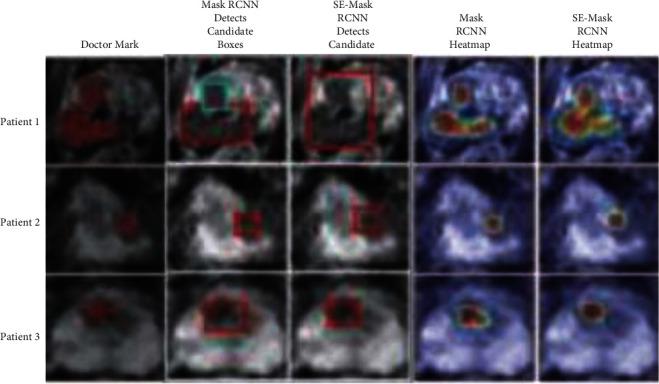 https://cdn.ncbi.nlm.nih.gov/pmc/blobs/d9a5/9167116/06a3ca58763f/CIN2022-5497120.008.jpg