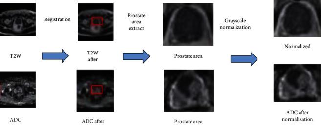 https://cdn.ncbi.nlm.nih.gov/pmc/blobs/d9a5/9167116/ac059e448ca7/CIN2022-5497120.003.jpg