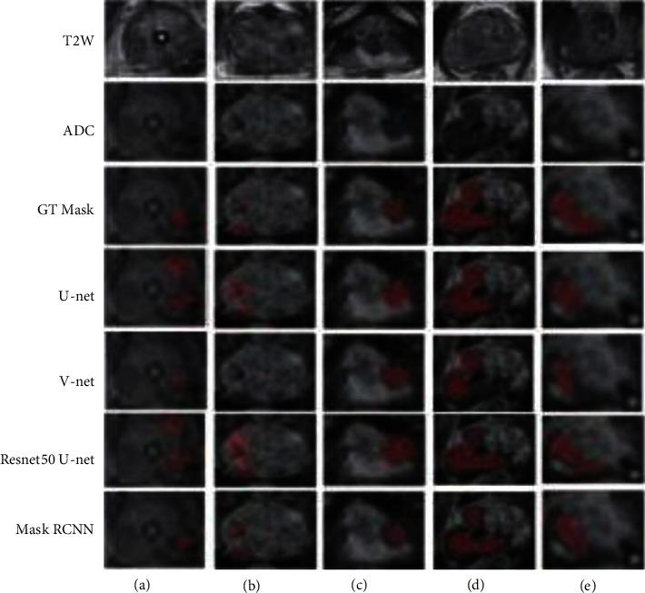 https://cdn.ncbi.nlm.nih.gov/pmc/blobs/d9a5/9167116/edd8895b9910/CIN2022-5497120.007.jpg