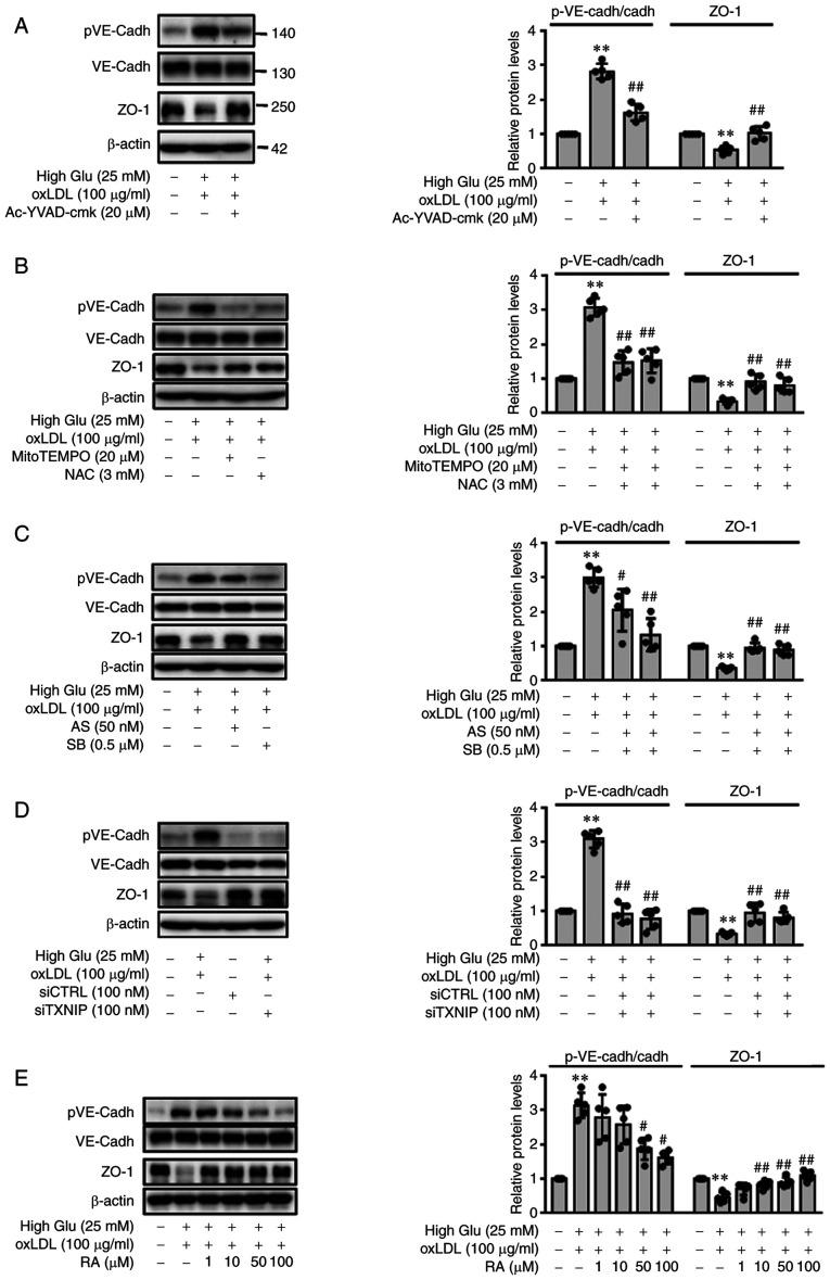 https://cdn.ncbi.nlm.nih.gov/pmc/blobs/d9a9/8989427/2283d0bc121c/IJMM-49-05-05125-g01.jpg
