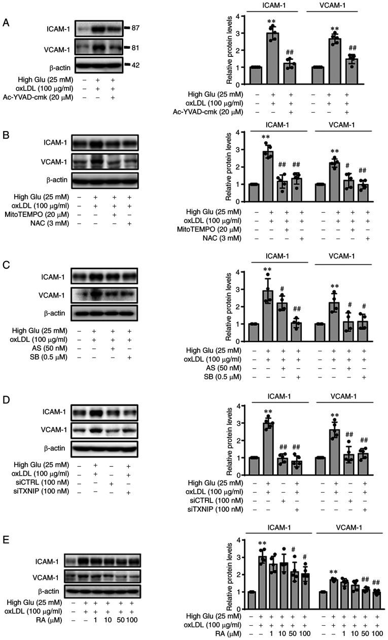 https://cdn.ncbi.nlm.nih.gov/pmc/blobs/d9a9/8989427/36a9ee9529e7/IJMM-49-05-05125-g00.jpg