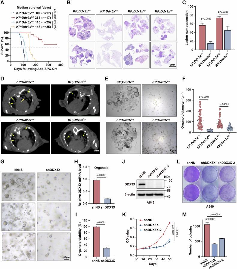 https://cdn.ncbi.nlm.nih.gov/pmc/blobs/d9aa/12398621/808bf256e374/41419_2025_7980_Fig1_HTML.jpg