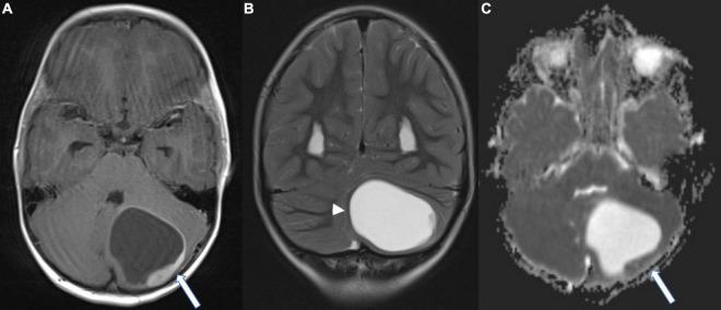 https://cdn.ncbi.nlm.nih.gov/pmc/blobs/d9aa/8984181/3fb0bb0a2fb2/fnins-16-810645-g001.jpg