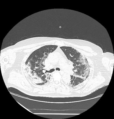 https://cdn.ncbi.nlm.nih.gov/pmc/blobs/d9b0/10248483/01905a38b84e/CHSJ-48-04-426-fig2a.jpg