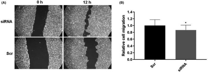 https://cdn.ncbi.nlm.nih.gov/pmc/blobs/d9b7/9169165/bf1d152da7a0/JCLA-36-e24442-g002.jpg