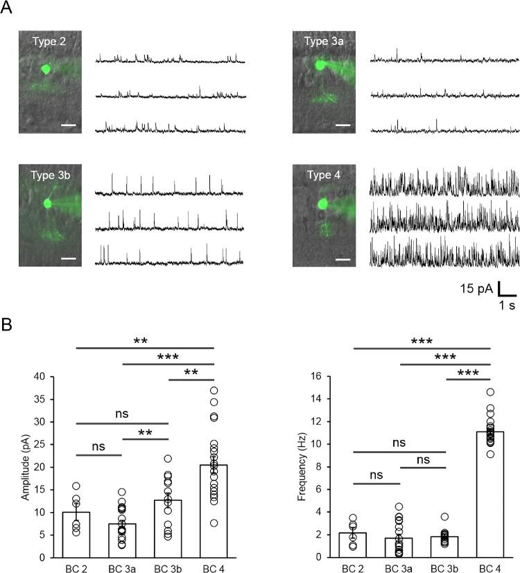 https://cdn.ncbi.nlm.nih.gov/pmc/blobs/d9bb/7401570/5cc0520f1b3f/iovs-61-3-3-f001.jpg