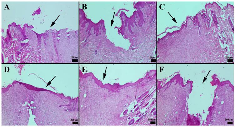https://cdn.ncbi.nlm.nih.gov/pmc/blobs/d9bd/12192460/f4f2f522c3ab/gels-11-00431-g011.jpg