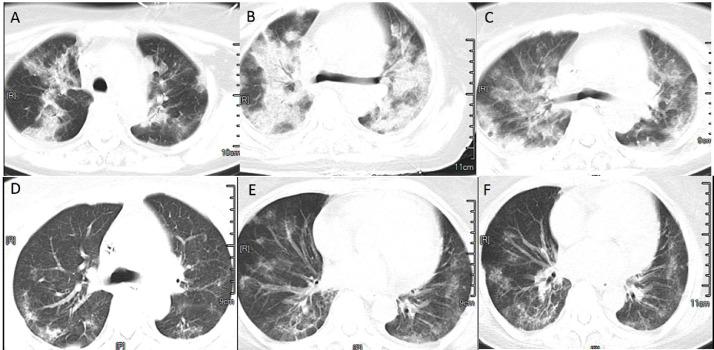 https://cdn.ncbi.nlm.nih.gov/pmc/blobs/d9c2/9923963/63b752f2edbe/gr2.jpg