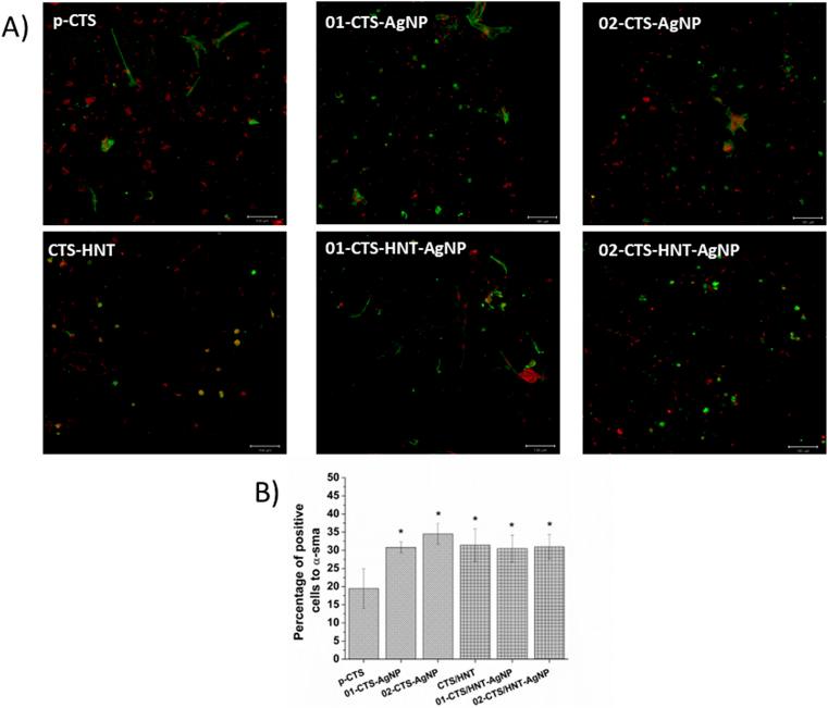 https://cdn.ncbi.nlm.nih.gov/pmc/blobs/d9c5/11310750/40e70d50f2f2/d4ra04274c-f10.jpg