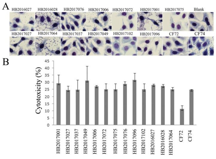 https://cdn.ncbi.nlm.nih.gov/pmc/blobs/d9d1/7157202/ff653993a86a/pathogens-09-00195-g005.jpg