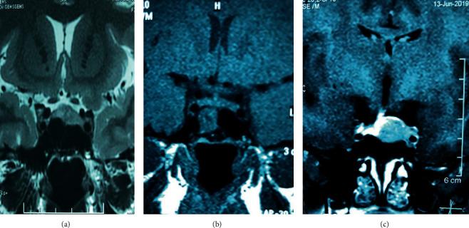 https://cdn.ncbi.nlm.nih.gov/pmc/blobs/d9e1/7895553/9fbca2bdd818/CRIE2021-6632436.001.jpg