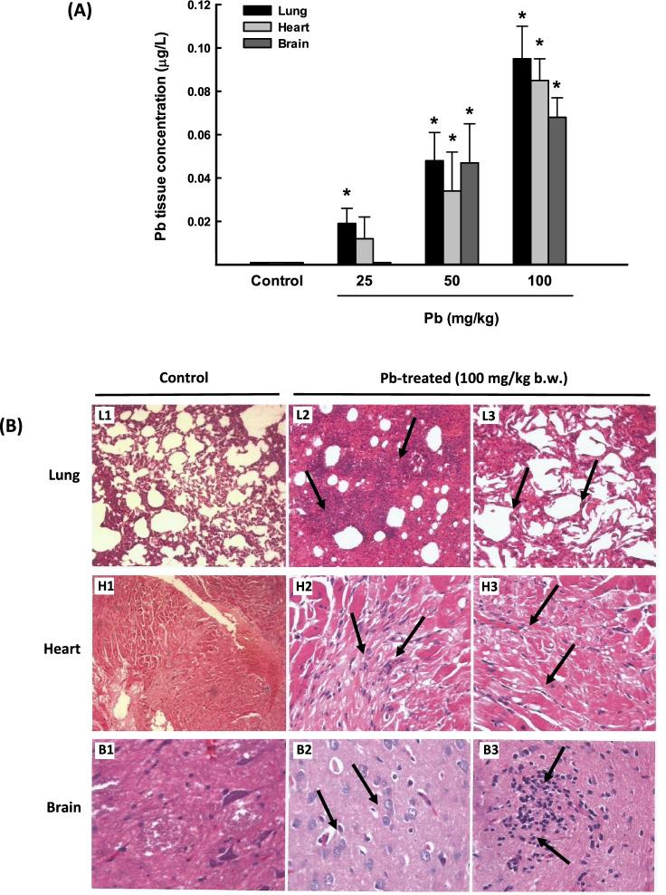 https://cdn.ncbi.nlm.nih.gov/pmc/blobs/d9e2/9481511/ebd0e696a4fc/11356_2022_19980_Fig1_HTML.jpg