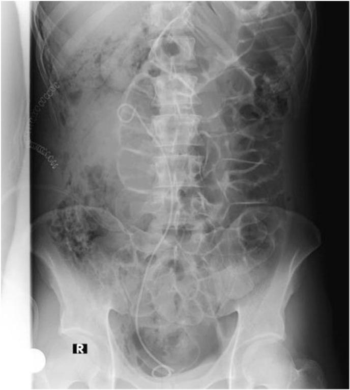 https://cdn.ncbi.nlm.nih.gov/pmc/blobs/d9e5/11782891/27d8f5bf936d/gr4.jpg