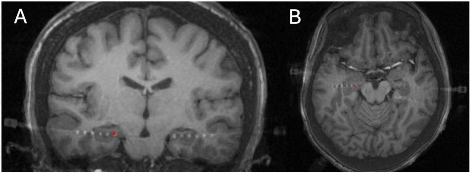https://cdn.ncbi.nlm.nih.gov/pmc/blobs/d9ea/12288141/cd1b2c65d54f/nihms-2089037-f0001.jpg