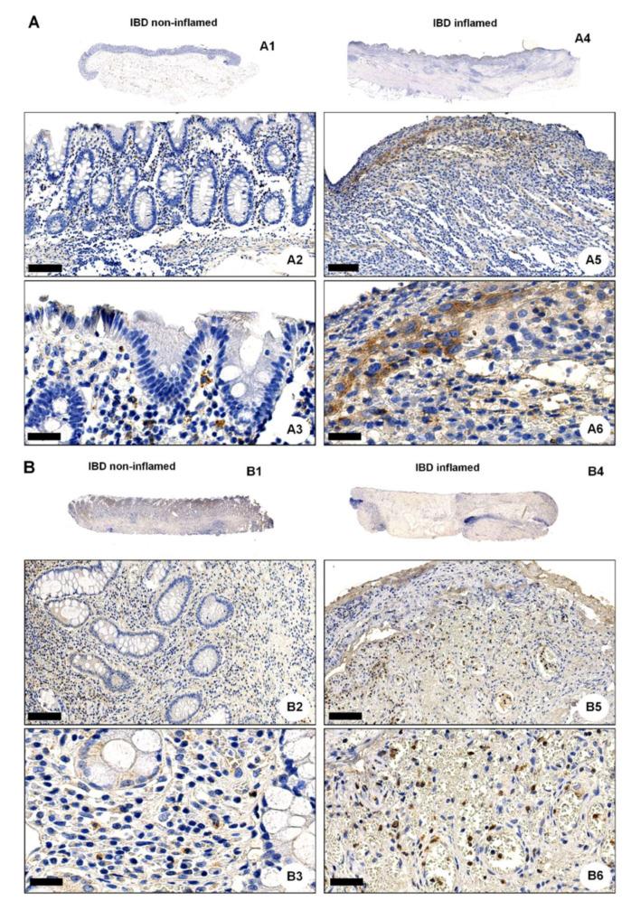 https://cdn.ncbi.nlm.nih.gov/pmc/blobs/d9eb/8835966/7bf530165730/ijms-23-01419-g003a.jpg