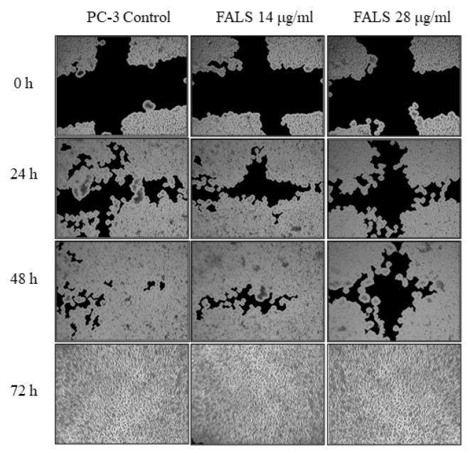 https://cdn.ncbi.nlm.nih.gov/pmc/blobs/d9ec/10890652/038db6259460/jof-10-00130-g0A3.jpg