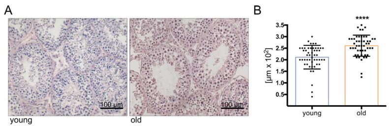 https://cdn.ncbi.nlm.nih.gov/pmc/blobs/d9f2/8225046/414c0016ff28/cells-10-01306-g001.jpg