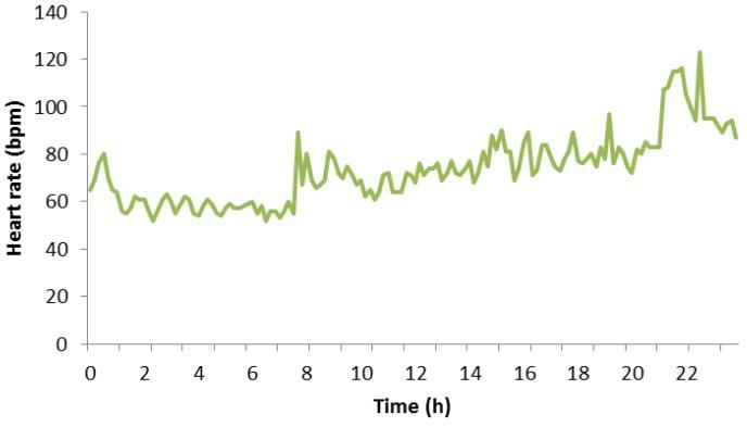https://cdn.ncbi.nlm.nih.gov/pmc/blobs/d9f6/6111836/8d289c3aae6f/sensors-18-02652-g009.jpg