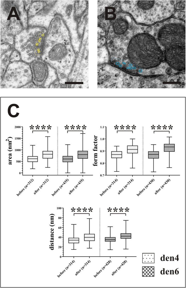 https://cdn.ncbi.nlm.nih.gov/pmc/blobs/d9f7/8093522/226a95778daa/fnana-15-652422-g010.jpg