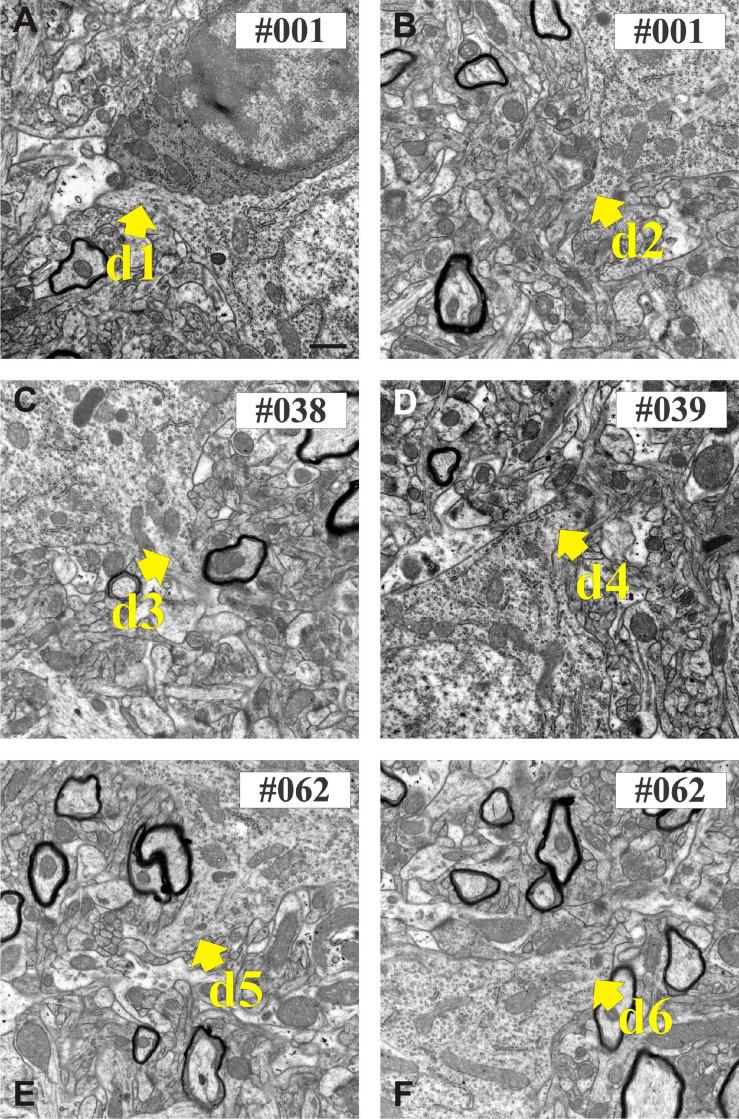 https://cdn.ncbi.nlm.nih.gov/pmc/blobs/d9f7/8093522/c27353db0943/fnana-15-652422-g006.jpg