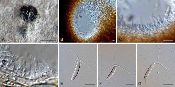 https://cdn.ncbi.nlm.nih.gov/pmc/blobs/d9fa/4107892/ec32a653fd25/ima-5-1-141-g002.jpg