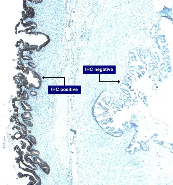 https://cdn.ncbi.nlm.nih.gov/pmc/blobs/d9fb/2803495/6b25709873be/1471-2407-9-433-5.jpg