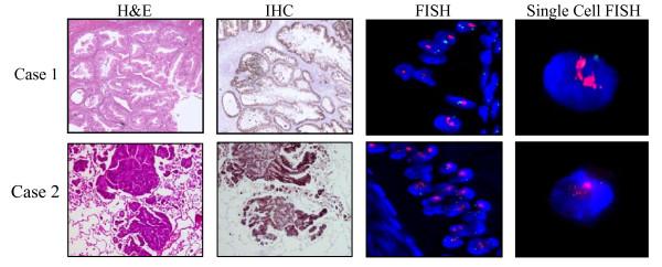 https://cdn.ncbi.nlm.nih.gov/pmc/blobs/d9fb/2803495/a301ff2da9d8/1471-2407-9-433-3.jpg