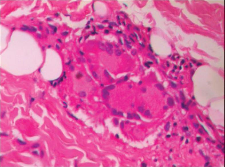 https://cdn.ncbi.nlm.nih.gov/pmc/blobs/d9fc/4763698/54095e2460c0/IJD-61-70-g004.jpg