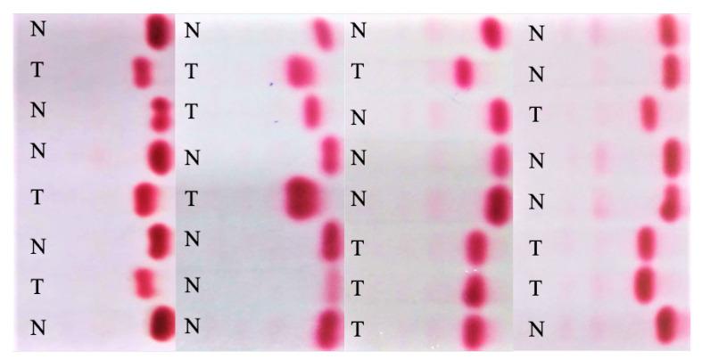 https://cdn.ncbi.nlm.nih.gov/pmc/blobs/da06/9600204/288f5bf056e8/diagnostics-12-02405-g004.jpg