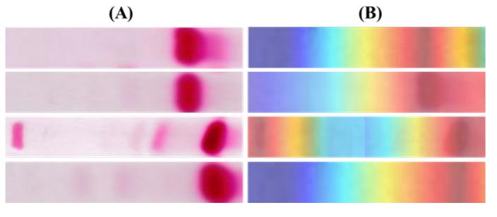 https://cdn.ncbi.nlm.nih.gov/pmc/blobs/da06/9600204/60d97414bd3d/diagnostics-12-02405-g012.jpg