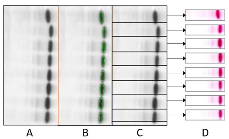https://cdn.ncbi.nlm.nih.gov/pmc/blobs/da06/9600204/fcb68b90db25/diagnostics-12-02405-g007.jpg