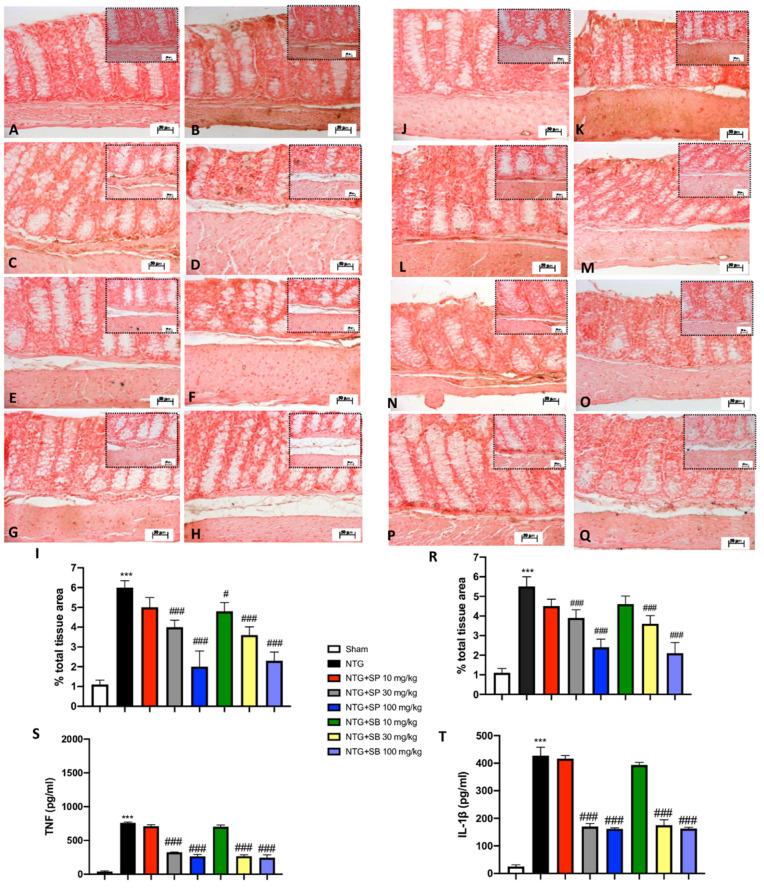 https://cdn.ncbi.nlm.nih.gov/pmc/blobs/da07/8535085/296f16f5c0a8/cells-10-02756-g005.jpg