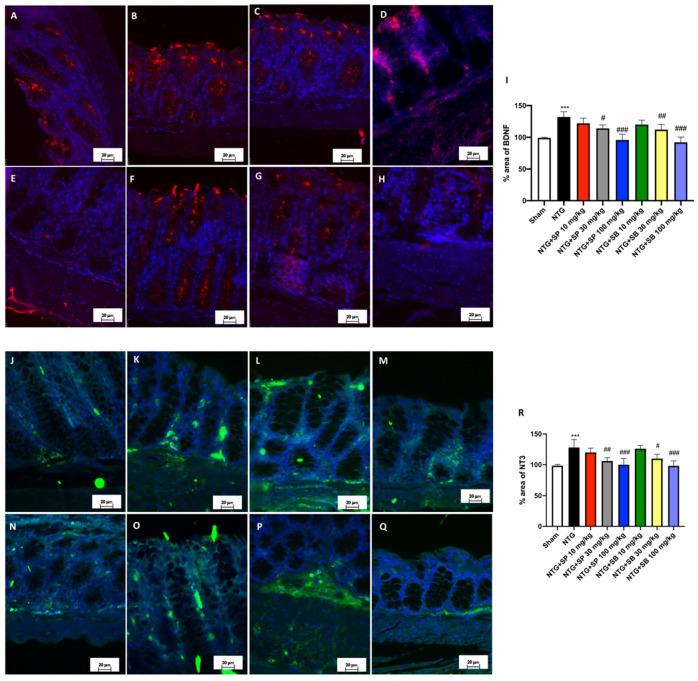 https://cdn.ncbi.nlm.nih.gov/pmc/blobs/da07/8535085/6b92c7c80bdd/cells-10-02756-g006.jpg