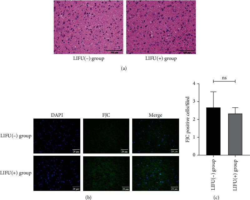 https://cdn.ncbi.nlm.nih.gov/pmc/blobs/da0a/9338851/303d1545874d/NP2022-6472475.002.jpg