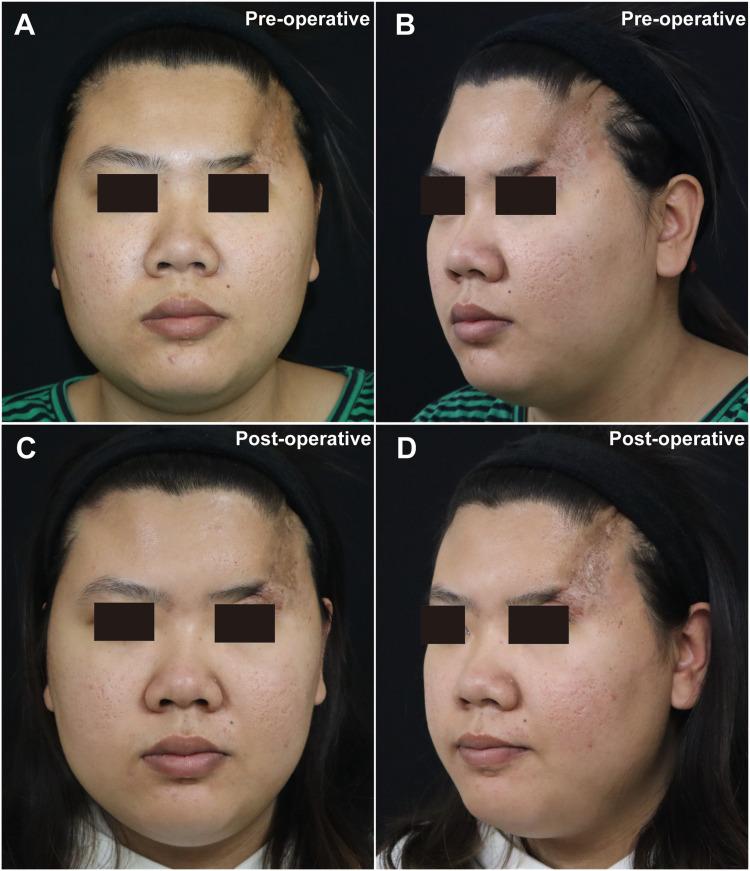https://cdn.ncbi.nlm.nih.gov/pmc/blobs/da0f/10476651/531c0d058120/CCID-16-2375-g0001.jpg
