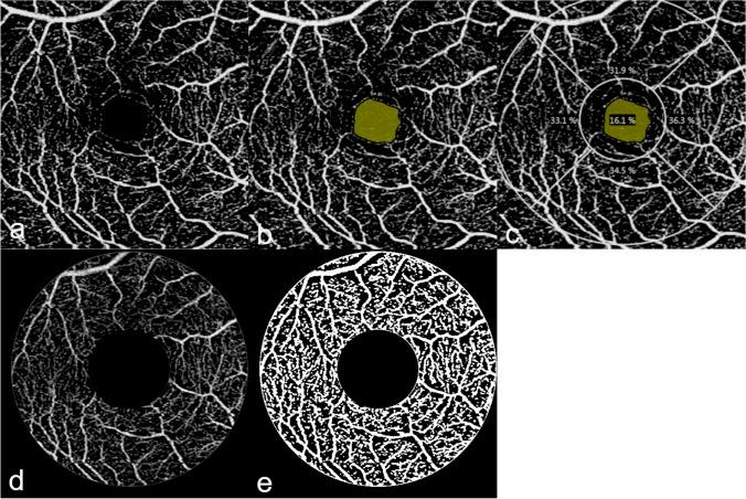 https://cdn.ncbi.nlm.nih.gov/pmc/blobs/da16/8850224/e50d54472d96/417_2021_5321_Fig2_HTML.jpg