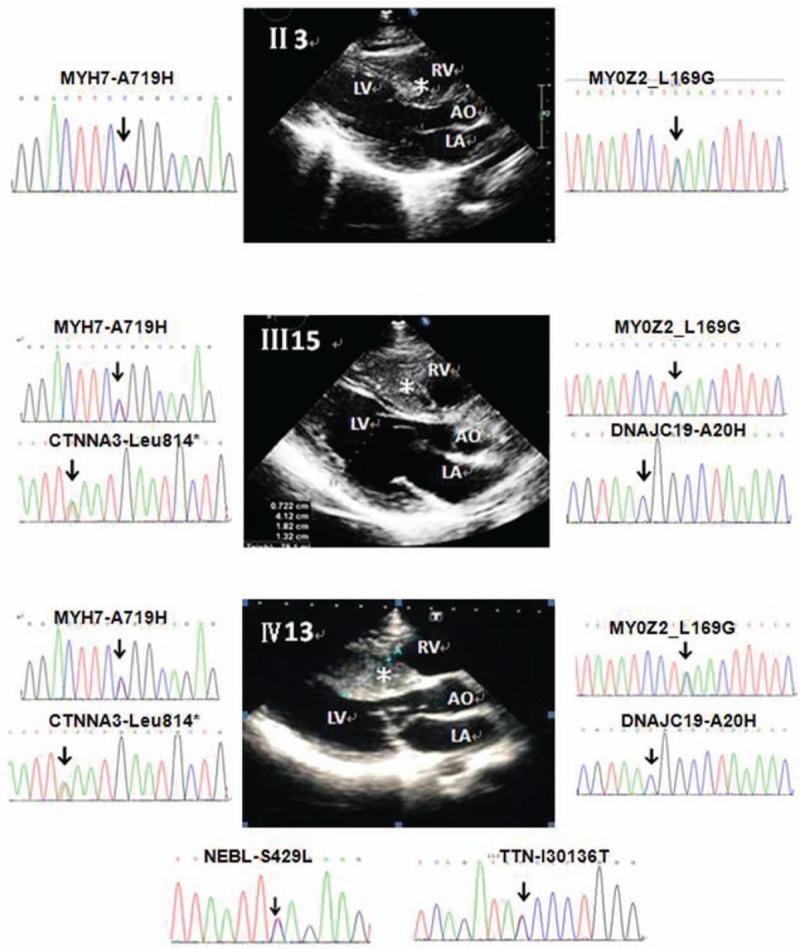 https://cdn.ncbi.nlm.nih.gov/pmc/blobs/da1e/5369889/5f6ab9afabc0/medi-96-e6249-g005.jpg