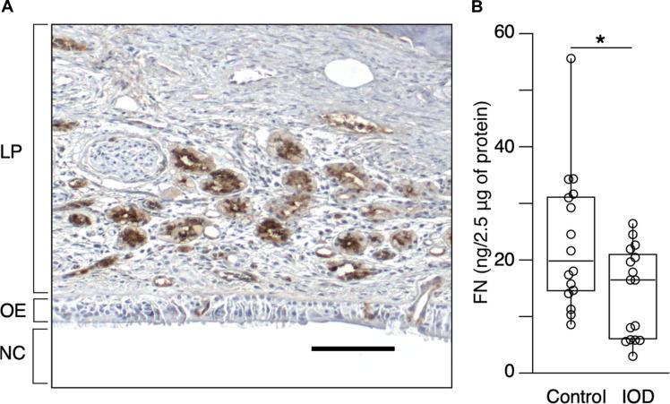 https://cdn.ncbi.nlm.nih.gov/pmc/blobs/da21/12077508/a3ea4ef1258b/sciadv.adu7271-f8.jpg