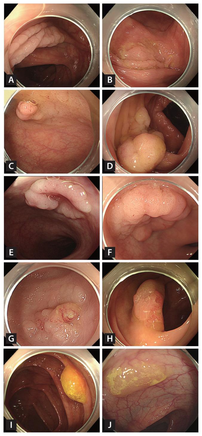 https://cdn.ncbi.nlm.nih.gov/pmc/blobs/da29/10175875/83575b90b59a/kjim-2022-322f2.jpg