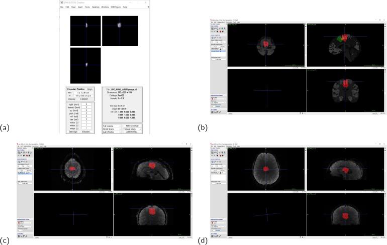 https://cdn.ncbi.nlm.nih.gov/pmc/blobs/da2e/11141335/4e2fed7a0e94/j_joeb-2024-0006_fig_005.jpg