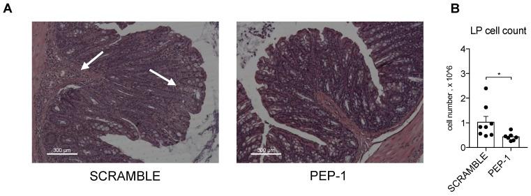 https://cdn.ncbi.nlm.nih.gov/pmc/blobs/da35/10528232/b41927783acb/cells-12-02294-g006.jpg