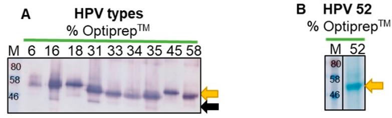https://cdn.ncbi.nlm.nih.gov/pmc/blobs/da3c/7762164/826799065b97/vaccines-08-00740-g001a.jpg