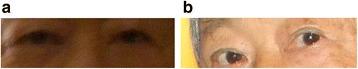 https://cdn.ncbi.nlm.nih.gov/pmc/blobs/da41/5508627/c0ead55a937a/13256_2017_1304_Fig2_HTML.jpg