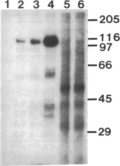 https://cdn.ncbi.nlm.nih.gov/pmc/blobs/da43/281862/ba078189bc4c/pnas00295-0101-a.jpg