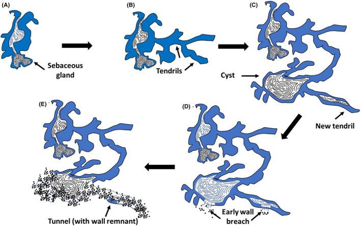 https://cdn.ncbi.nlm.nih.gov/pmc/blobs/da48/8247901/47c998bcedc6/EXD-30-820-g004.jpg