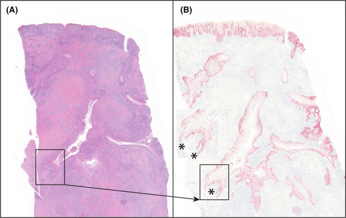 https://cdn.ncbi.nlm.nih.gov/pmc/blobs/da48/8247901/77cdf63a435f/EXD-30-820-g002.jpg