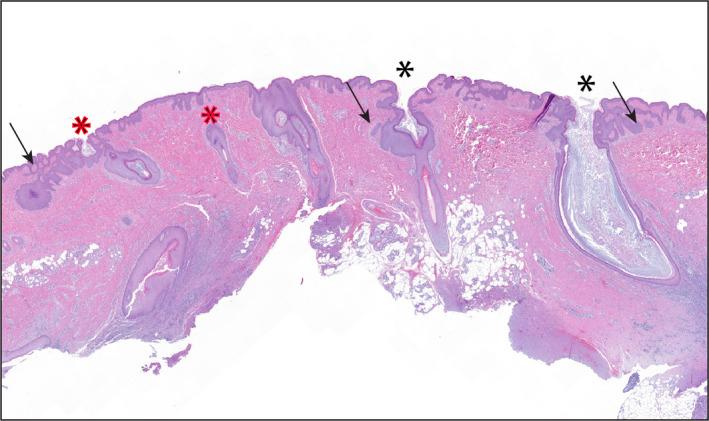 https://cdn.ncbi.nlm.nih.gov/pmc/blobs/da48/8247901/a3eabf5da9b4/EXD-30-820-g001.jpg