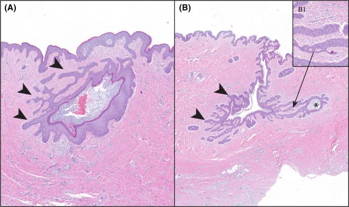 https://cdn.ncbi.nlm.nih.gov/pmc/blobs/da48/8247901/ae481a397930/EXD-30-820-g003.jpg
