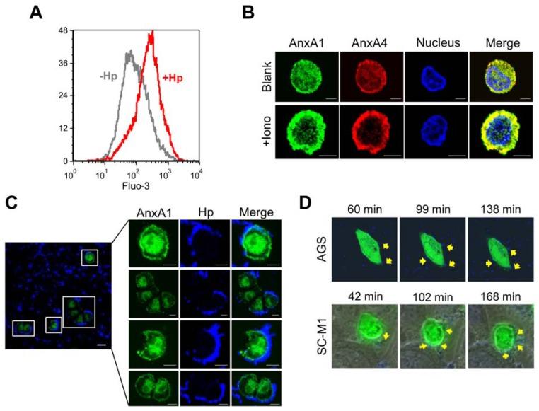 https://cdn.ncbi.nlm.nih.gov/pmc/blobs/da4a/3431852/5a405878c048/ijms-13-10176f3.jpg